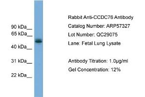 WB Suggested Anti-CCDC76  Antibody Titration: 0. (CCDC76 Antikörper  (N-Term))