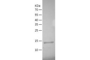 Western Blotting (WB) image for Acyl-CoA Thioesterase 13 (ACOT13) (AA 1-140) protein (His tag) (ABIN7121686) (THEM2 Protein (AA 1-140) (His tag))
