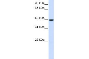 WB Suggested Anti-AGPAT5 Antibody Titration:  0.