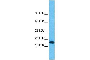 Host:  Rabbit  Target Name:  PNKD  Sample Type:  HepG2 Whole Cell lysates  Antibody Dilution:  1. (PNKD Antikörper  (N-Term))