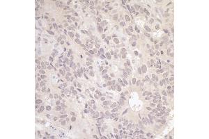 Immunohistochemistry (IHC) image for anti-Replication Factor C (Activator 1) 3, 38kDa (RFC3) (AA 80-110) antibody (ABIN7449406)