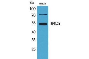 Western Blotting (WB) image for anti-serine Palmitoyltransferase, Long Chain Base Subunit 1 (SPTLC1) (C-Term) antibody (ABIN3187765) (SPTLC1 Antikörper  (C-Term))