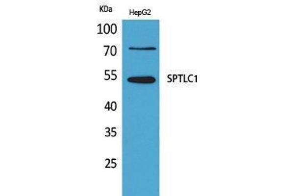 SPTLC1 antibody  (C-Term)