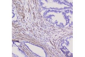 IHC analysis of NSE using anti-NSE antibody (ABIN6719549). (ENO2/NSE Antikörper)