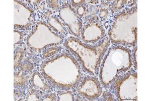 IHC analysis of TTC11/FIS1 using anti-TTC11/FIS1 antibody (ABIN7600321). (Fission 1 Antikörper  (AA 18-152))