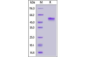 Human PVRIG, Mouse IgG2a Fc Tag on  under reducing (R) condition. (PVRIG Protein (AA 41-171) (mFc Tag))