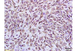 Formalin-fixed and paraffin embedded mouse mesenchymal stem cells labeled Anti-Vimentin Polyclonal Antibody, Unconjugated (ABIN672786) at 1:300, followed by conjugation to the secondary antibody and DAB staining (Vimentin Antikörper  (AA 371-466))