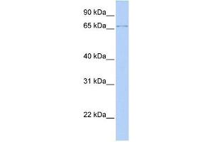 Transfected 293T; WB Suggested Anti-ZFP64 Antibody Titration: 0. (ZFP64 Antikörper  (N-Term))