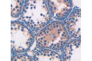 IHC-P analysis of Kidney tissue, with DAB staining. (Angiotensin I Converting Enzyme 1 Antikörper  (AA 334-409))