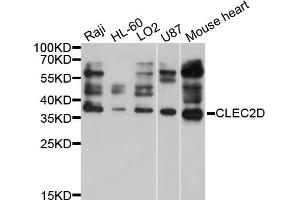 Western blot analysis of extracts of various cell lines, using CLEC2D antibody (ABIN4903312) at 1:1000 dilution.