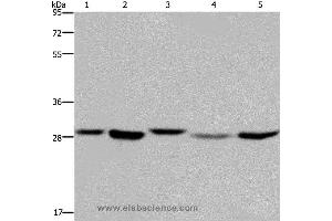 Western blot analysis of 293T, MCF-7 and PC3 cell, human fetal liver tissue and Hela cell, using ECHS1 Polyclonal Antibody at dilution of 1:300 (ECHS1 Antikörper)