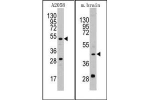Image no. 1 for anti-Plasminogen Activator, Urokinase (PLAU) (AA 68-98), (N-Term) antibody (ABIN2853629) (PLAU Antikörper  (N-Term))