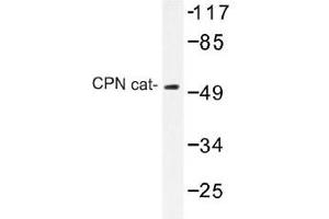Image no. 1 for anti-Carboxypeptidase N Subunit 1 (CPN1) antibody (ABIN317900) (CPN1 Antikörper)
