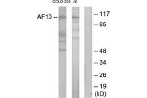 Western blot analysis of extracts from COLO205/Jurkat cells, using AF10 Antibody.