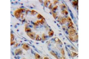 Used in DAB staining on fromalin fixed paraffin-embedded Stomach tissue (ENO1 Antikörper  (AA 78-241))