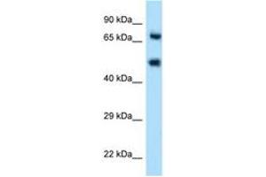 Image no. 1 for anti-Selectin E (SELE) (AA 81-130) antibody (ABIN6746548) (Selectin E/CD62e Antikörper  (AA 81-130))