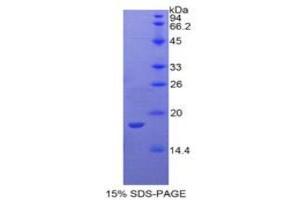 SDS-PAGE analysis of Rabbit Interleukin 1 alpha Protein. (IL1A Protein)