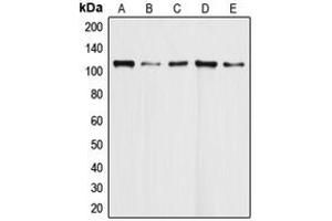 Western blot analysis of DAXX expression in HeLa (A), Molt4 (B), Ramos (C), K562 (D), HEK293T (E) whole cell lysates. (DAXX Antikörper  (Center))