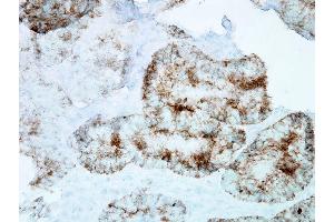 Immunohistochemistry analysis using Mouse Anti-Hsp60 Monoclonal Antibody, Clone LK-1 . (HSPD1 Antikörper  (APC))