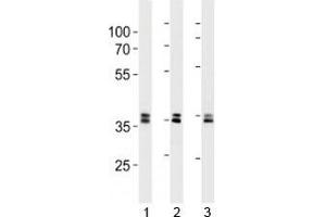 UCH37 antibody western blot analysis in 293, HeLa, 293T lysate. (UCHL5 Antikörper)