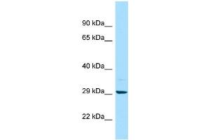 WB Suggested Anti-MAPRE2 Antibody Titration: 1. (MAPRE2 Antikörper  (C-Term))