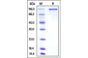 Mouse Transferrin R2, mouse IgG1 Fc Tag on SDS-PAGE under reducing (R) condition.