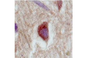 Immunohistochemistry with Brain, cortex tissue at an antibody concentration of 2. (SLC18A1 Antikörper  (Middle Region))
