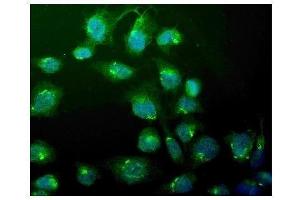 IF analysis of WEE1 using anti-WEE1 antibody (ABIN6719614). (WEE1 Antikörper)