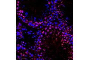 Immunofluorescence (Paraffin-embedded Sections) (IF (p)) image for anti-Homeobox C9 (HOXC9) antibody (ABIN7074251)