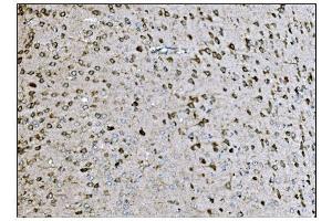 IHC analysis of LRP1B using anti-LRP1B antibody (ABIN7601521). (LRP1B Antikörper  (AA 3704-4547))