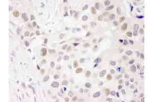 anti-Integrator Complex Subunit 7 (INTS7) (AA 850-900) antibody