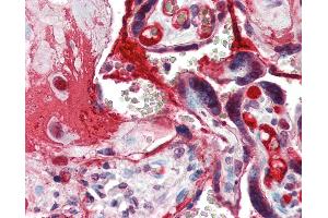 Anti-CCNE1 / Cyclin E1 antibody IHC of human placenta. (Cyclin E1 Antikörper  (C-Term))