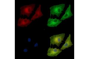ABIN7095474 and ABIN7099531 staining  cells by IF/ICC. (BRD9 Antikörper)