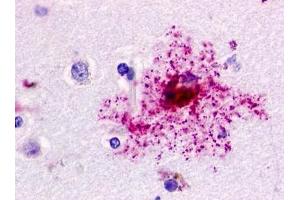 Immunohistochemical staining of Brain (Astrocyte) using anti- GPR84 antibody ABIN122097