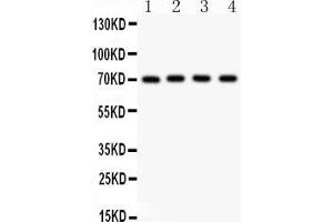 Anti- NRG1 Picoband antibody, Western blottingAll lanes: Anti NRG1  at 0. (Neuregulin 1 Antikörper  (AA 2-241))