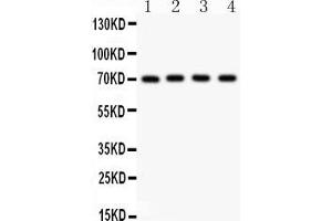 Anti- NRG1 Picoband antibody, Western blottingAll lanes: Anti NRG1  at 0.