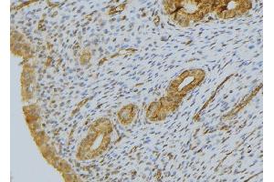 ABIN6276519 at 1/100 staining Human uterus tissue by IHC-P. (CYR61 Antikörper  (Internal Region))