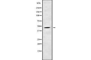 Western blot analysis NKAP using COLO205 whole cell lysates (NKAP Antikörper  (N-Term))