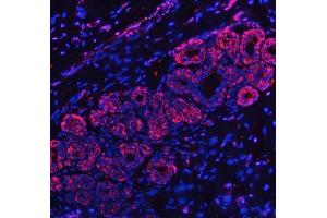 IF analysis of RPL32 using anti-RPL32 antibody (ABIN7602916). (RPL32 Antikörper  (C-Term))