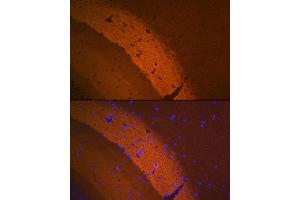 anti-Glutamate Receptor, Metabotropic 2 (GRM2) antibody