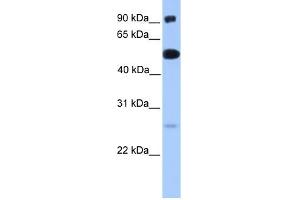 WB Suggested Anti-ETV5 Antibody Titration:  0. (ETV5 Antikörper  (N-Term))