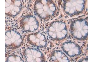 DAB staining on IHC-P; Samples: Human Intestine Tissue (RNASET2 Antikörper  (AA 25-256))