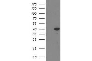 Western Blotting (WB) image for anti-Reticulon 4 Interacting Protein 1 (RTN4IP1) antibody (ABIN1500771) (RTN4IP1 Antikörper)