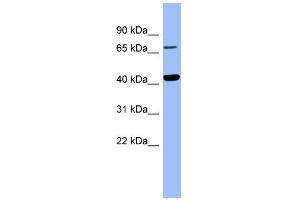 WB Suggested Anti-HPD Antibody Titration:  0.