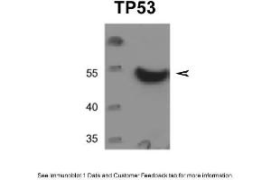 WB Suggested Anti-TP53 Antibody  Titration: 0. (p53 Antikörper  (C-Term))