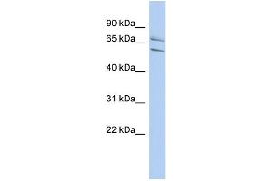 WB Suggested Anti-PHF21A Antibody Titration:  0. (PHF21A Antikörper  (N-Term))
