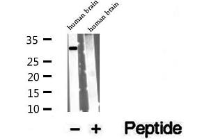 Western blot analysis of extracts of human brain tissue, using VDAC3 antibody. (VDAC3 Antikörper  (N-Term))