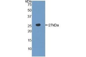 Detection of Recombinant TLR6, Human using Polyclonal Antibody to Toll Like Receptor 6 (TLR6)
