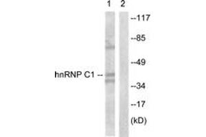 Western blot analysis of extracts from HuvEc cells, treated with EGF 200ng/ml 5', using hnRNP C1/2 (Ab-260) Antibody. (HNRNPC Antikörper  (AA 231-280))