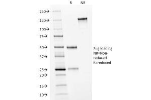 SDS-PAGE Analysis Purified HER-2 Mouse Monoclonal Antibody (HRB2/282). (ErbB2/Her2 Antikörper  (Extracellular Domain))